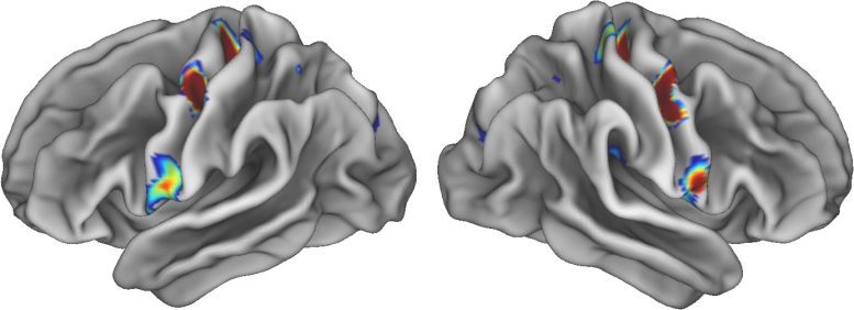 Mind-Body Connection Brain Scans