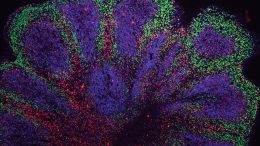 Mini-Brain Organoids Showing Cortex-Like Structures