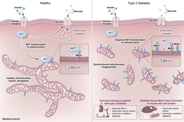Miro1 Role in Skeletal Muscle