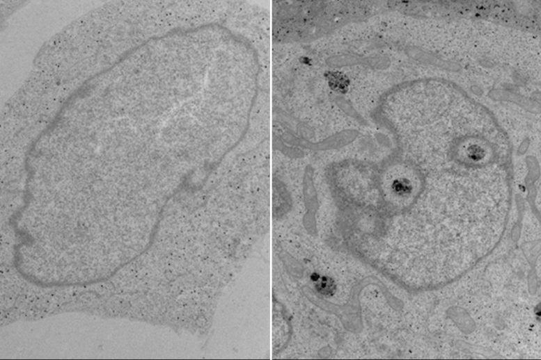 Mitochondria Depleted vs. Normal Human Embryonic Stem Cells