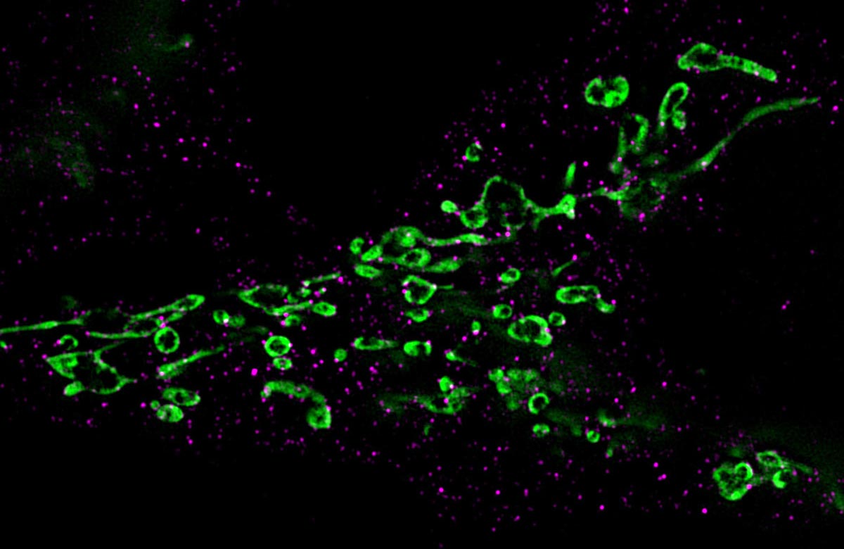 How Herpes Viruses Trigger Their Own Awakening How Herpes Viruses Trigger Their Own Awakening