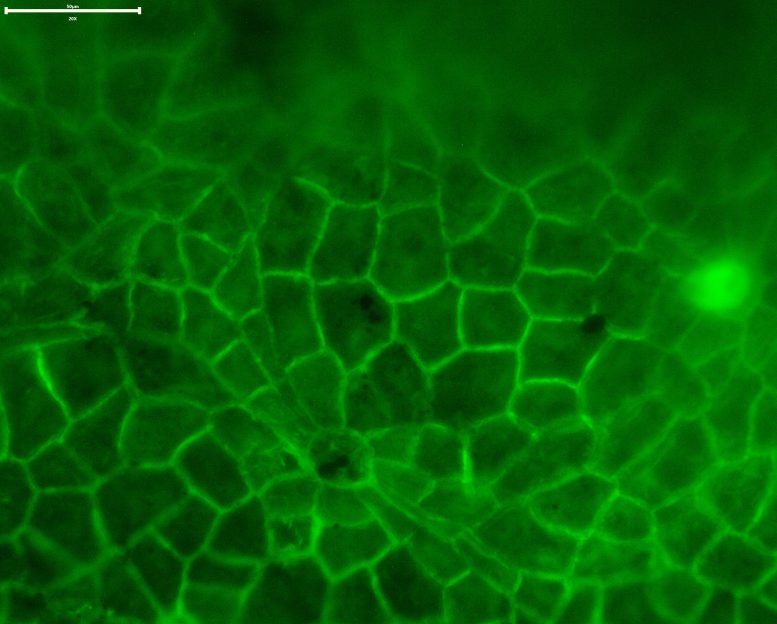Modern Leaf Cuticle Under Fluorescence Microscopy