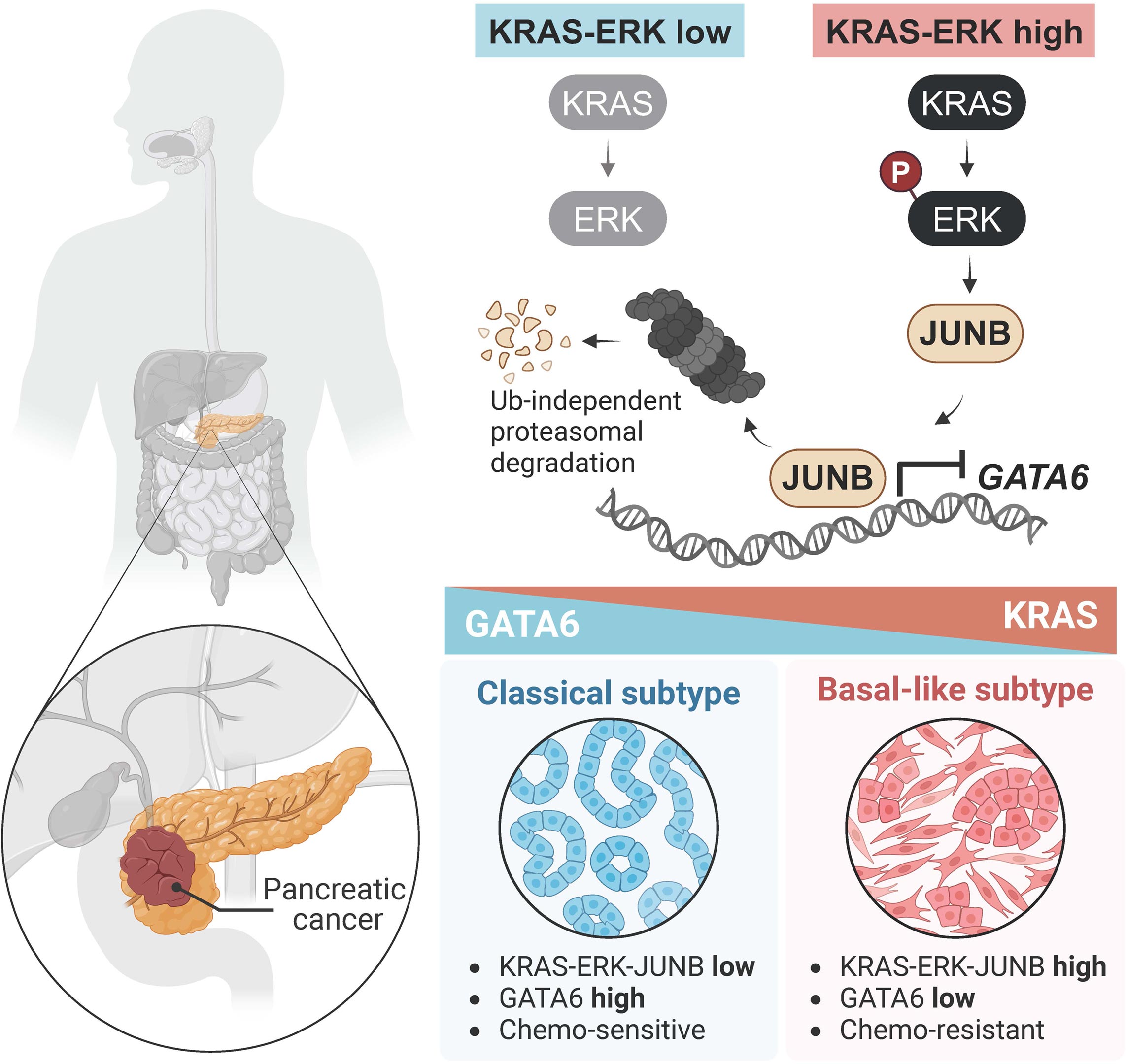 B Cells Pancreatic Cancer