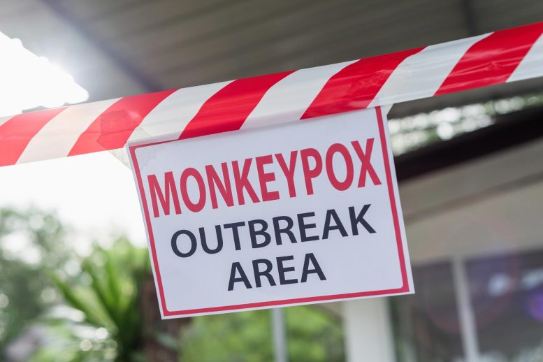 Monkeypox Outbreak Sign