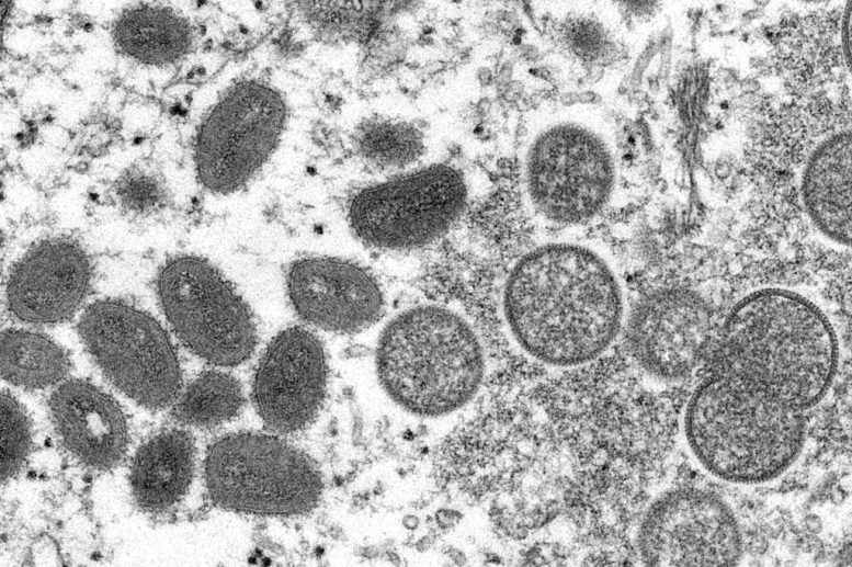 Monkeypox Poxviridae Viruses