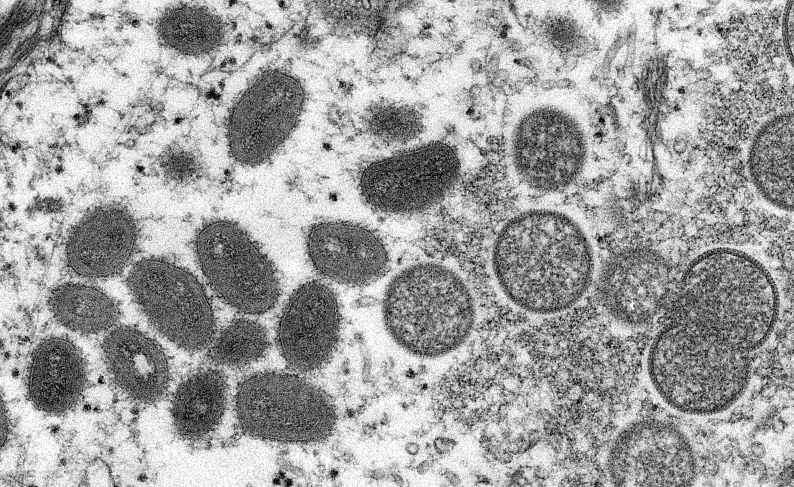 Erste vollständige DNA-Sequenz des Affenpockenvirus in der Schweiz