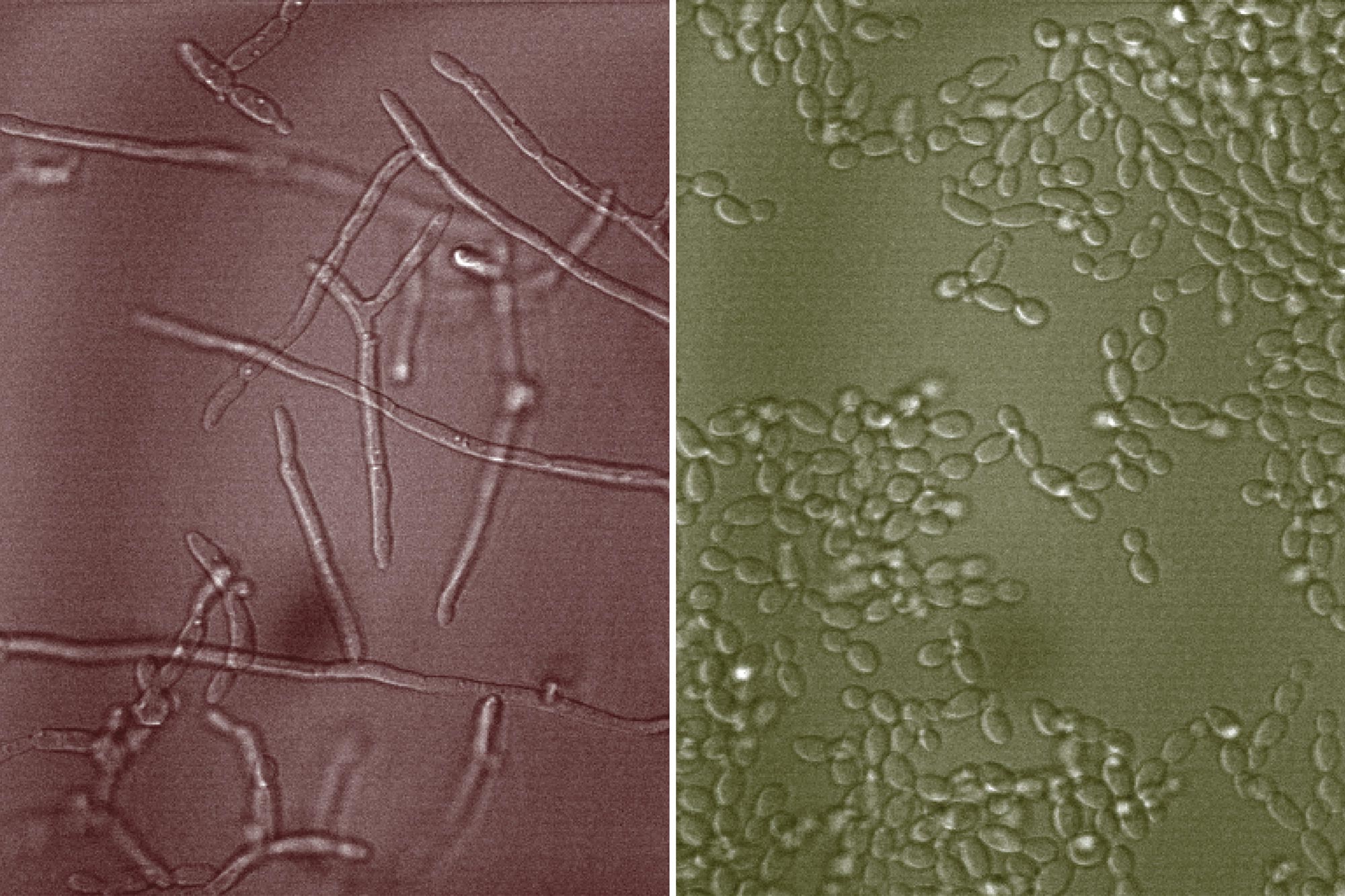 Candida Albicans Microscopic Appearance