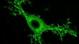 Mossy Brain Cells Linked to Seizures and Memory Loss