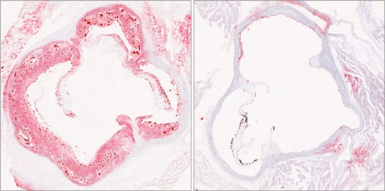 Mouse Aortic Root Plaque Comparison Microscopy Images