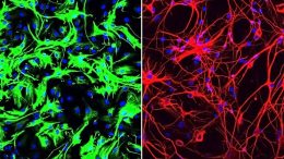 Mouse Astrocytes