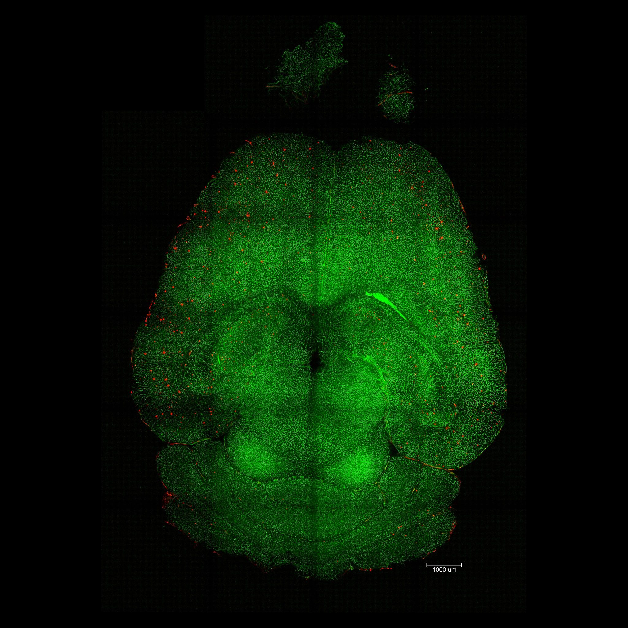 Scientists Reverse Alzheimer’s Disease in Mice With Impressive New ...