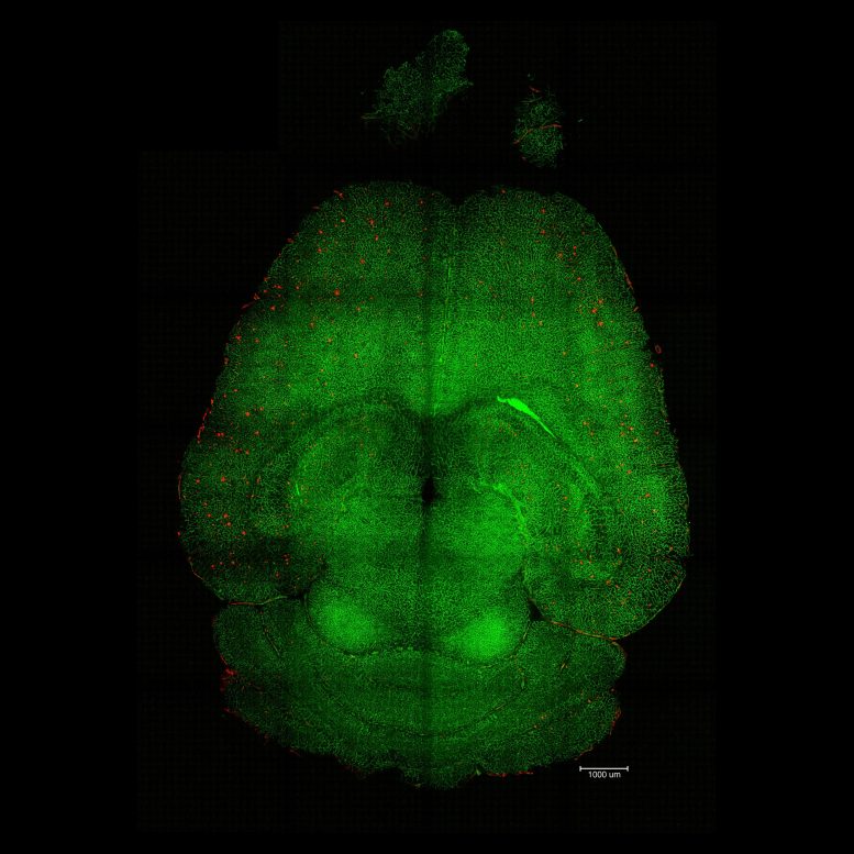 Mouse Brain After Nanoparticle Treatment