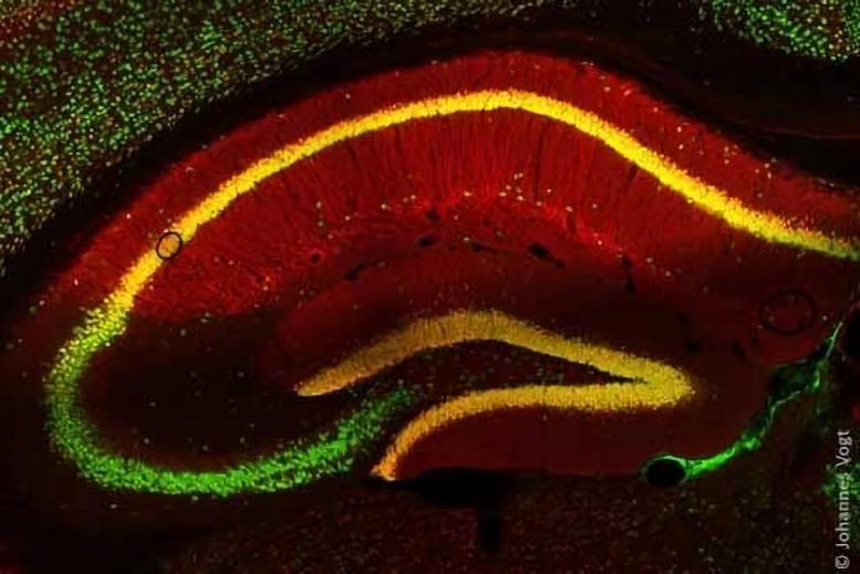 Mouse Brain Nerve Cells