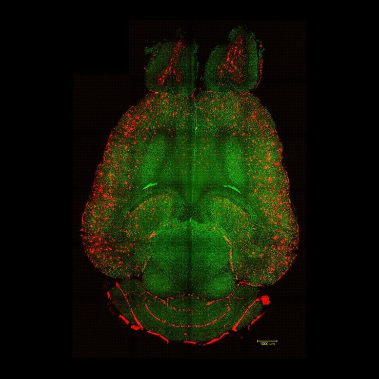 Mouse Brain Section Showing Amyloid β Plaques and Blood Vessels