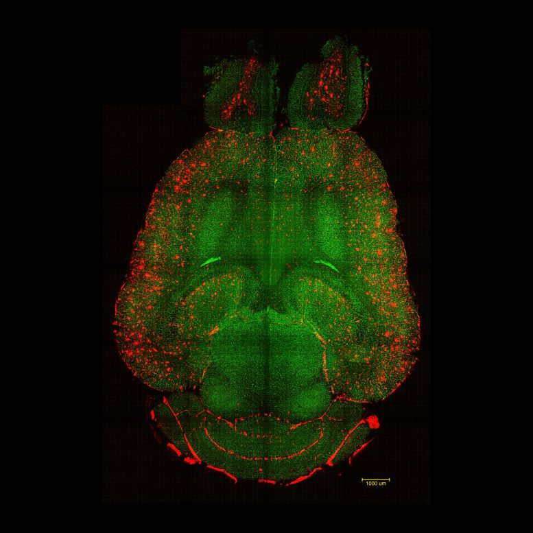 Mouse Brain Section Showing Amyloid β Plaques and Blood Vessels