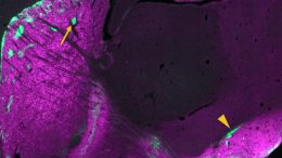 Mouse Brain Striosomal Neurons
