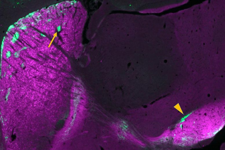 Mouse Brain Striosomal Neurons