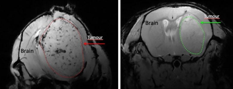 Crescita del tumore cerebrale nei topi trattati con niacina