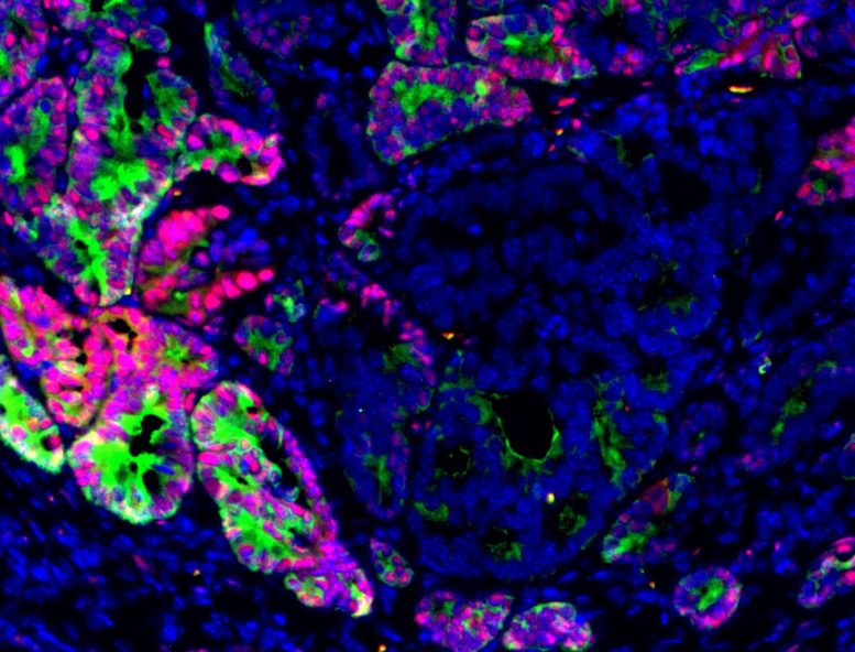 Mouse Colon Cancer Immunofluorescence Image