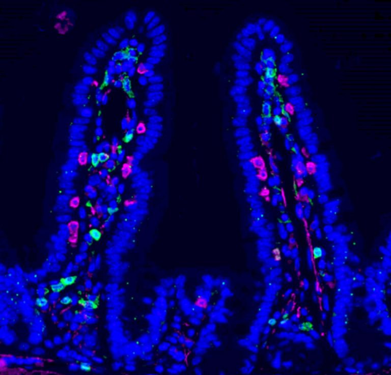 Mouse Lining A Hidden Effect of Chemotherapy Could Help Block Metastasis