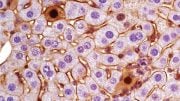 Mouse Liver Cells