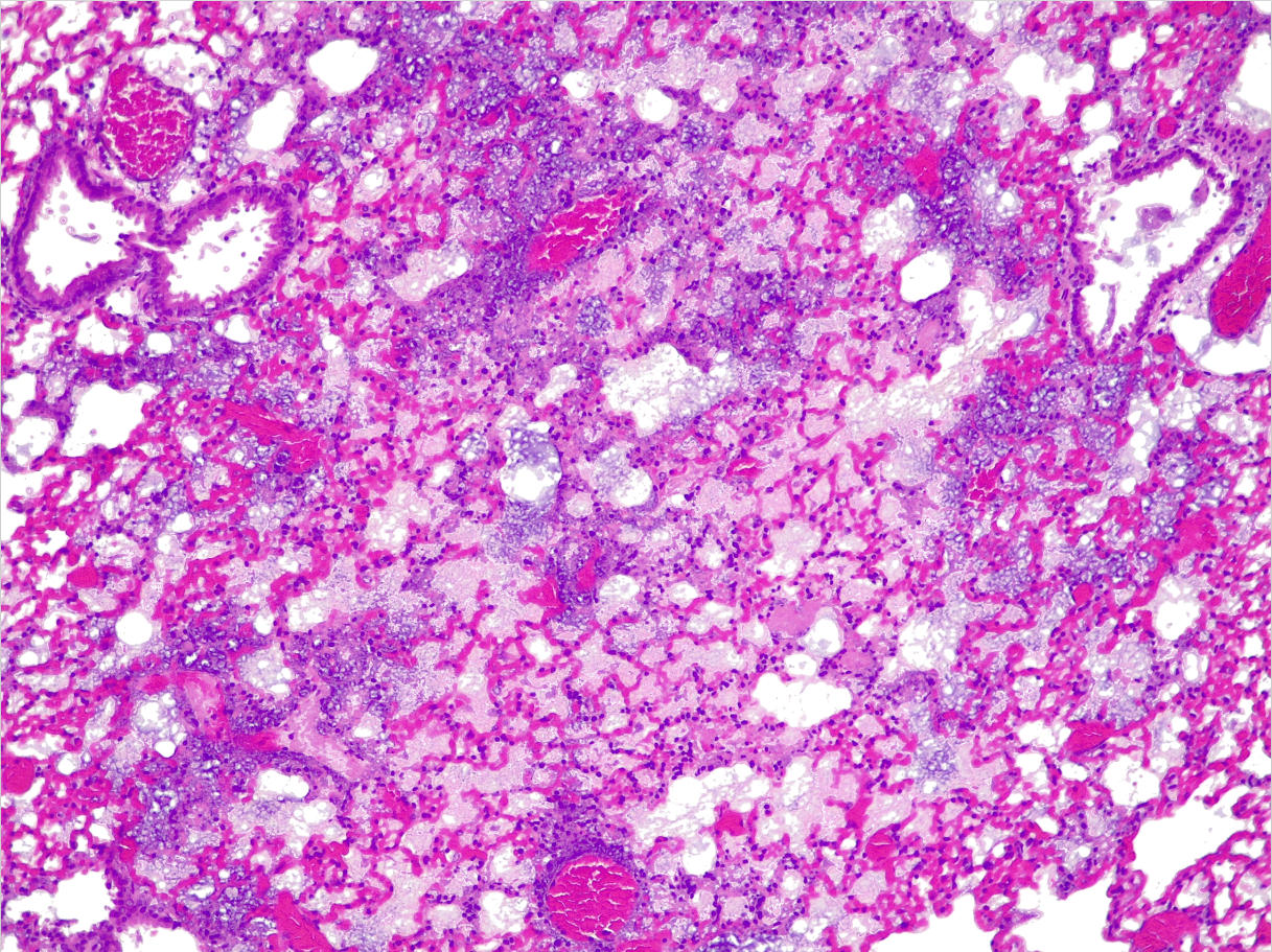 Mouse Lungs With Acute Drug Resistant Infection