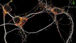 Mouse Neurons Mitochondria