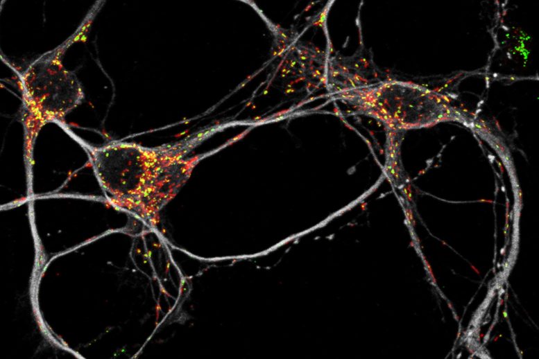 Mouse Neurons Mitochondria