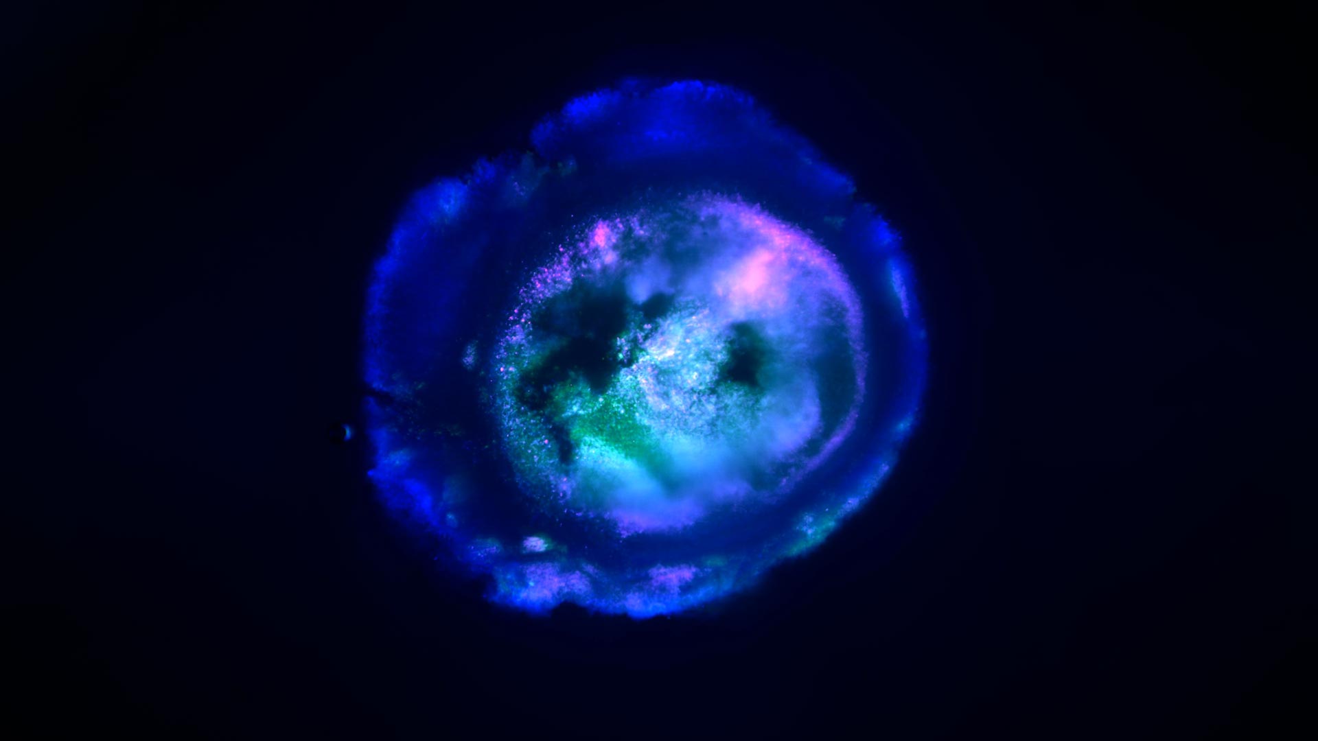 This Tiny Brain Grown in a Lab Could Revolutionize Mental Health Research