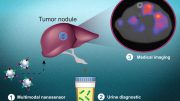 Multimodal Cancer Nanosensors