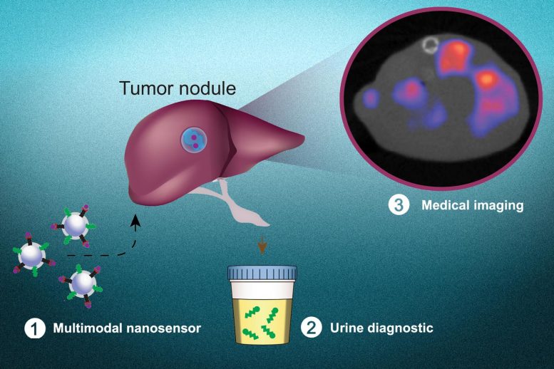Multimodal Cancer Nanosensors