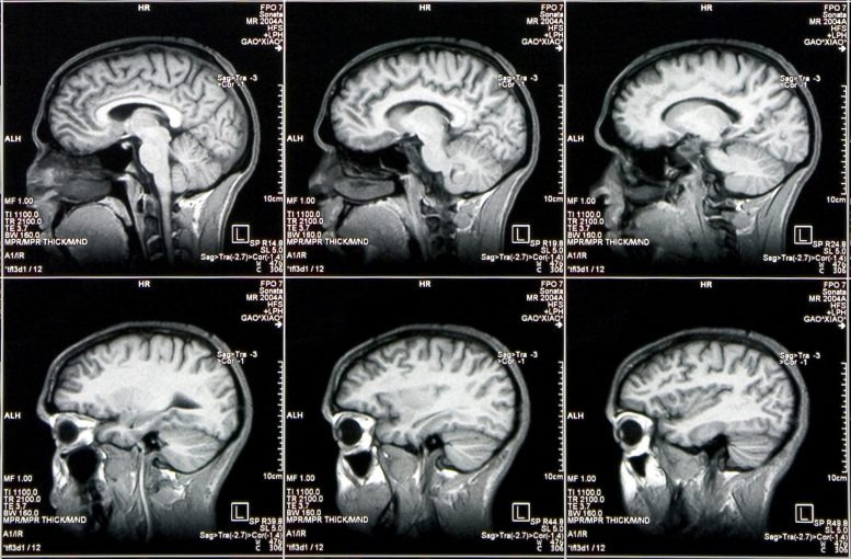 Multiple CAT Scan Brain Images