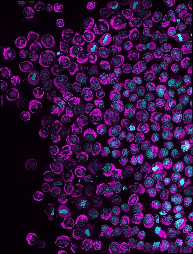 Multiple Confined Cancer Cells