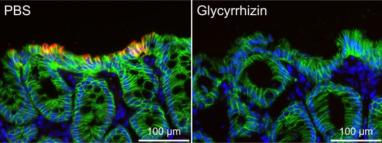 Murine Colitis Intestinal Tissue With Glycyrrhizin Treatment