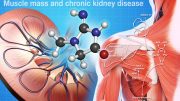 Muscle Mass is Not an Accurate a Predictor of Chronic Kidney Disease