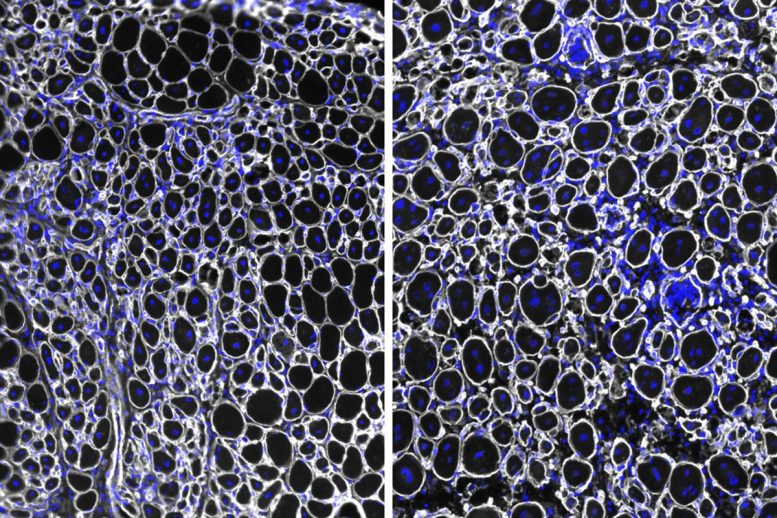Muscle Stem Cells With and Without NDRG1