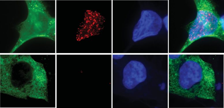 N4BP2 Enzyme Chromothripsis
