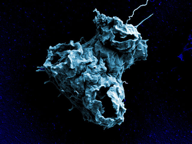 Naegleria gruberi Amoeba Cell Surface