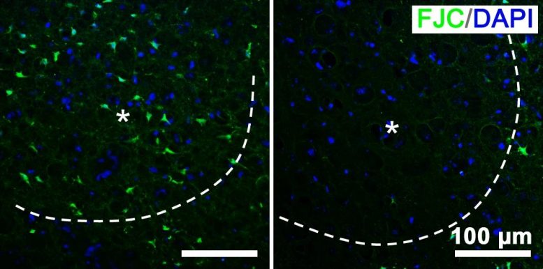 Nano-Photosynthetic Therapy Brain Slices