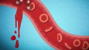 Nanoparticles Stopping Internal Bleeding