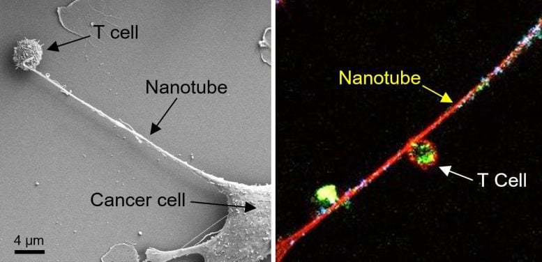 Nanotube Between Breast Cancer Cell and Immune Cell