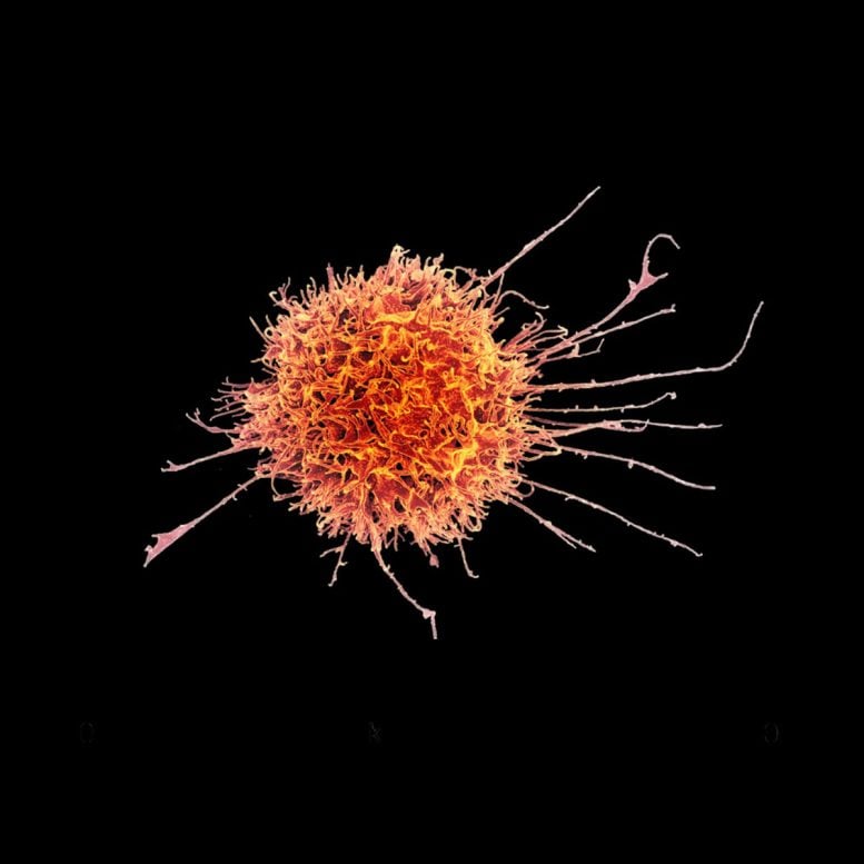 Natural Killer Cell Attacking Tumor