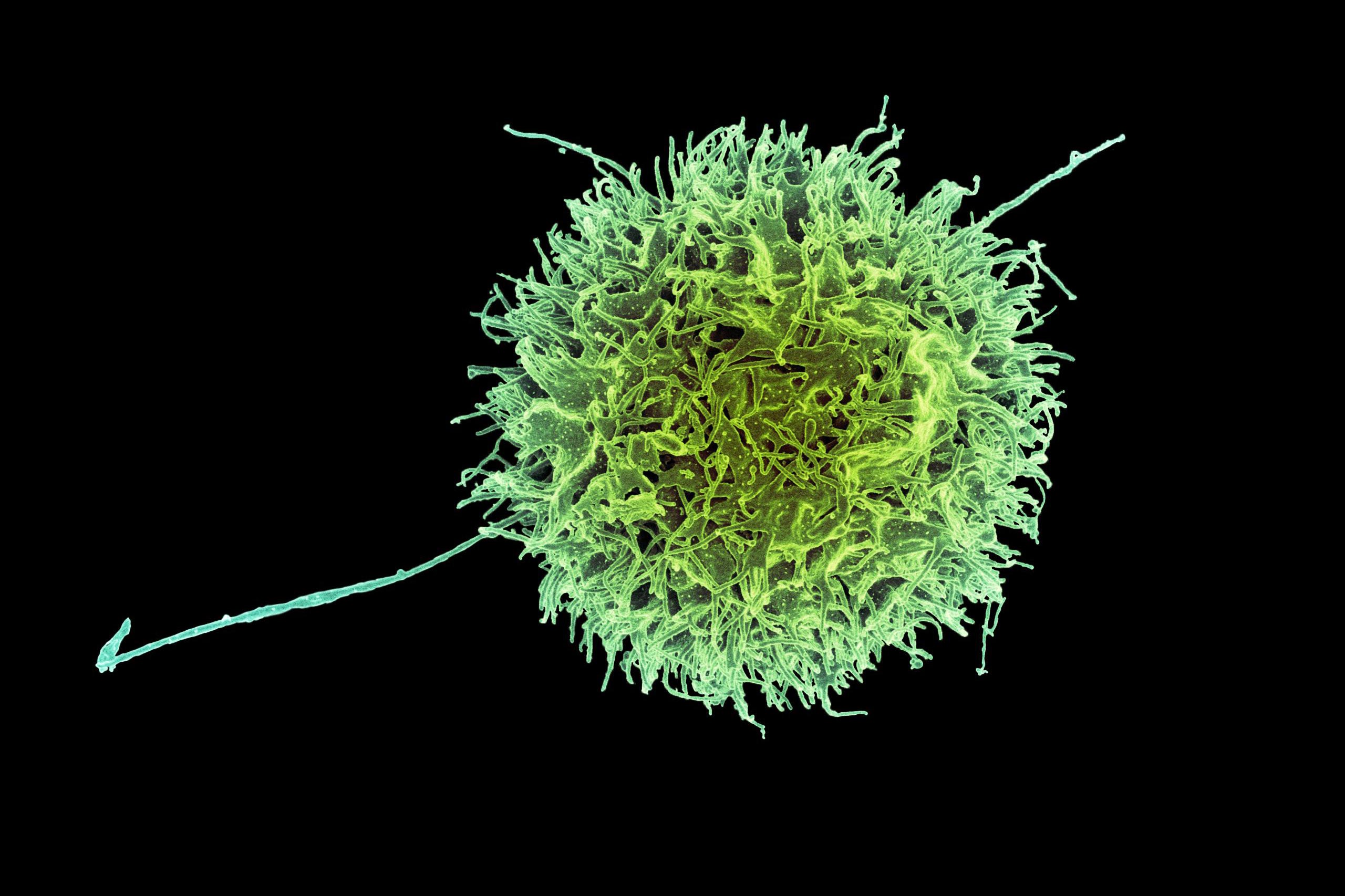 MIT and Harvard create "invisible" CAR-NK cells to fight cancer