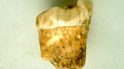 Neanderthal First Molar