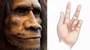 Neanderthal Viking Disease