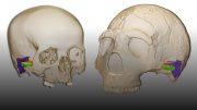 Neanderthal and Modern Human Cranium and Ear
