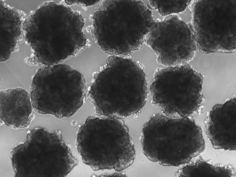 Neanderthalized Organoids