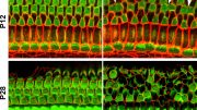 Nectin KO Mice Went Deaf Due to Loss of Hair Cells