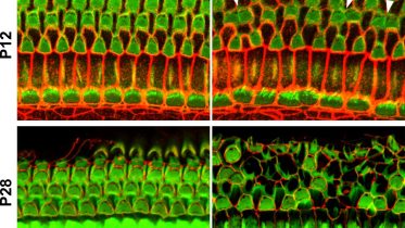 Nectin KO Mice Went Deaf Due to Loss of Hair Cells