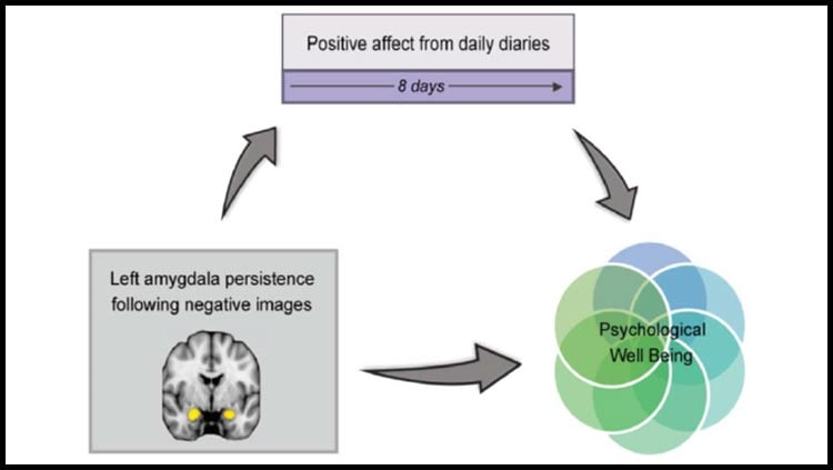 Negative Mood Linked to Prolonged Amygdala Activity